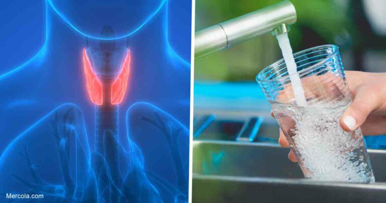 Thyroid Health Linked to Iodine Deficiency and Fluoridated Water