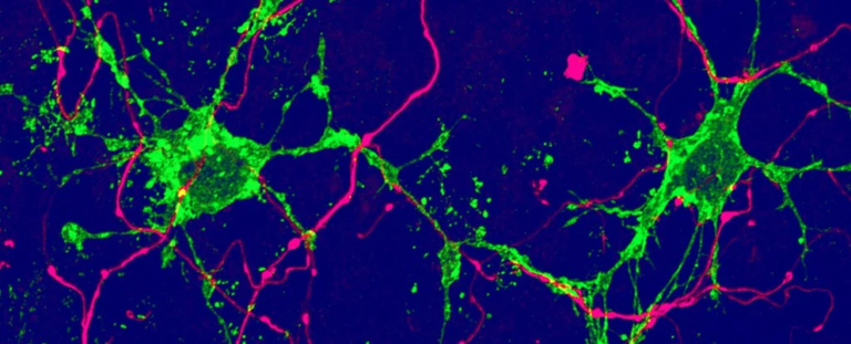 Two previously unknown brain cell types have been discovered in mouse study