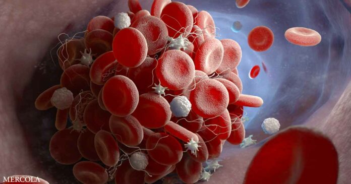 Antibody Titers: Vaccinated vs. Natural Infection — Which Is Better?