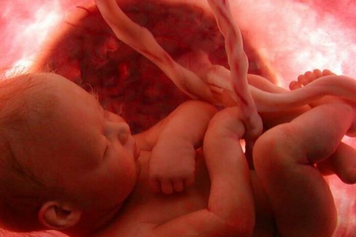 Electromagnetic fields and miscarriage