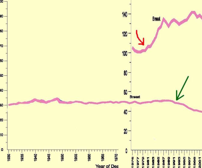 Rethink Pink and Screening Mammography