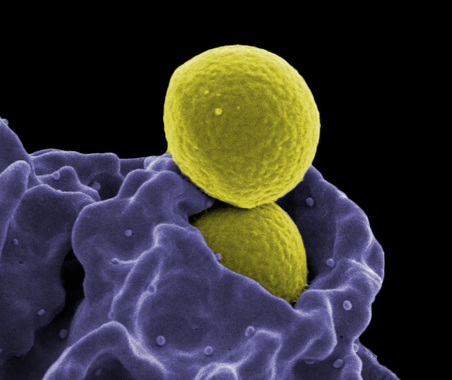Antimicrobial Resistance – The Looming Medical Apocalypse