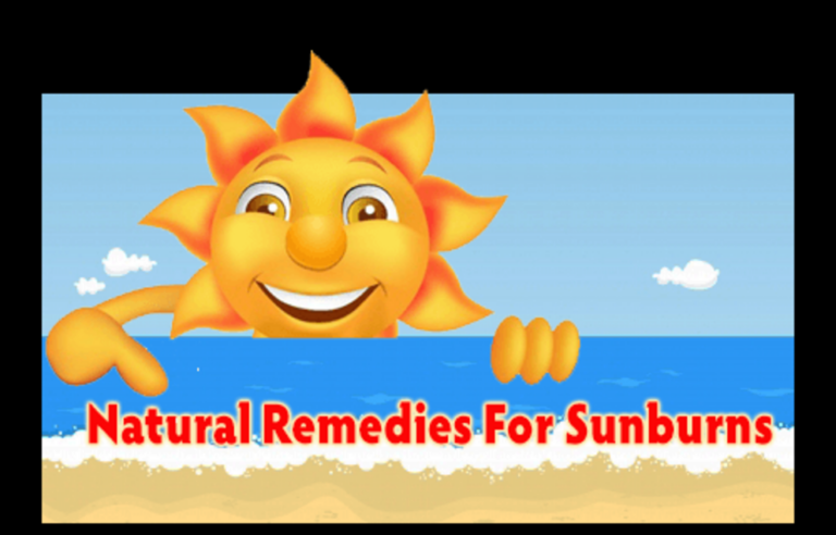 Natural remedies for sunburns