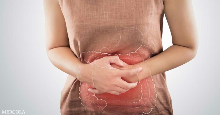 Vitamin D Insufficiency Linked to Irritable Bowel Syndrome