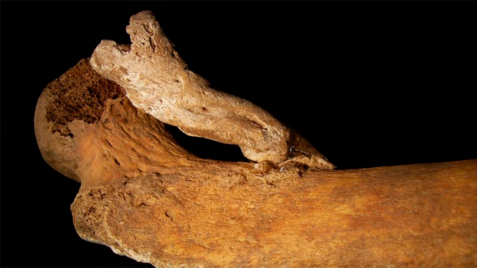 Curious bone growth found on Portuguese skeleton buried centuries ago
