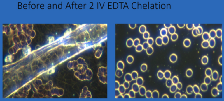Decontaminating the blood from synthetic biology hydrogel with EDTA chelation