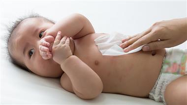 wet wipes cause food allergies sewer clogs