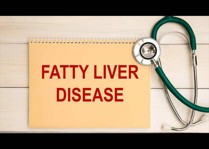 30% of Americans Have Fatty Liver Disease