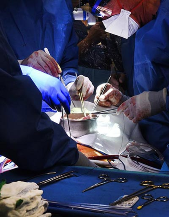 Lessons learned from first genetically-modified pig heart into human patient