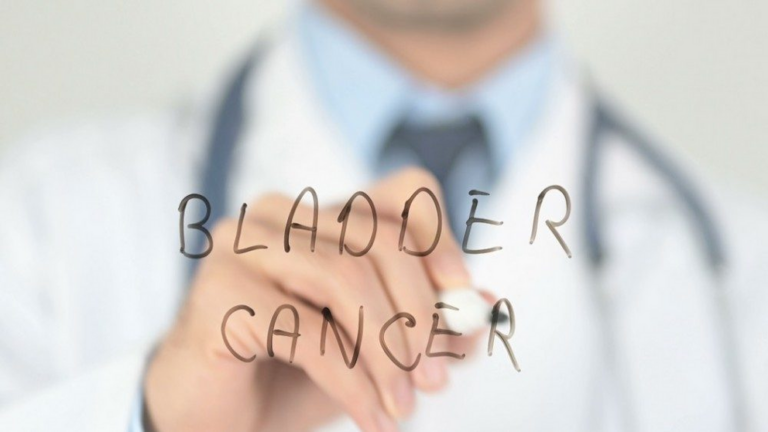 How to lower your risk for bladder cancer