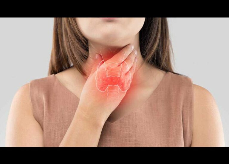 Are Your Adrenal Glands Affecting Your Thyroid?
