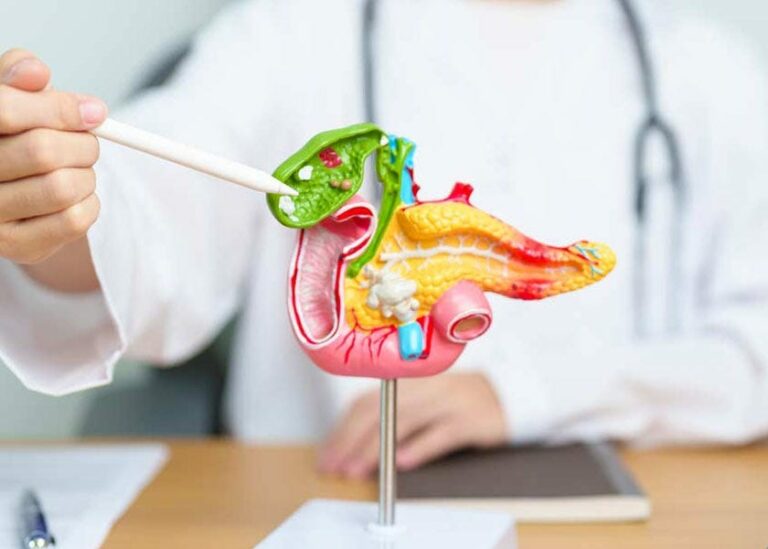 Is Your Gallbladder Causing Digestive Issues?