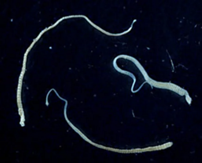 Tapeworms spread cancer in humans - are cancers the result of parasites?