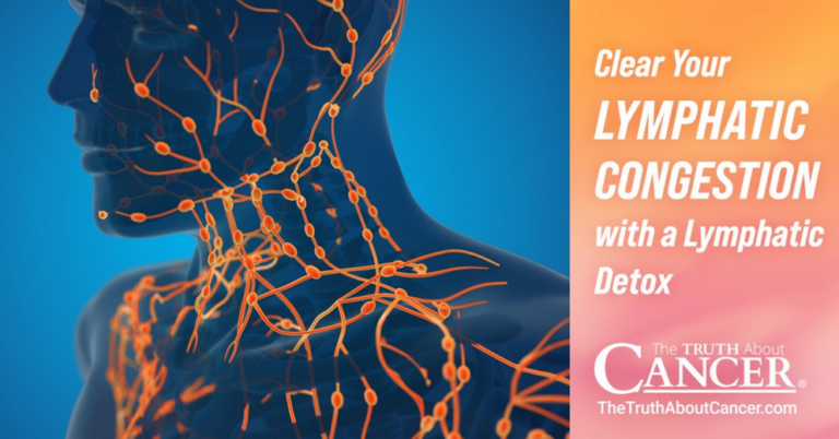 Clear your lymphatic congestion with a lymphatic detox