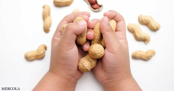 Guidelines Call for Introduction of Peanuts During Infancy to Reduce Risk of Allergy