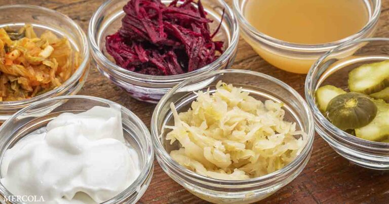 Could Eating More Fermented Foods Help Improve Mental Health?