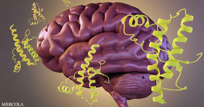 Doctors Predict Epidemic of Prion Brain Diseases