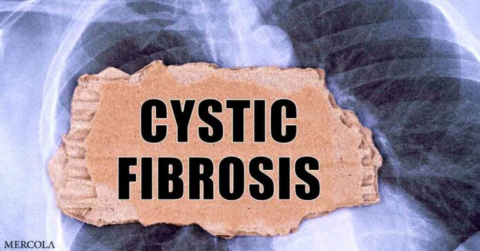 Natural Therapies for Cystic Fibrosis