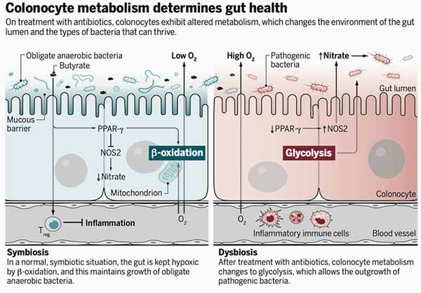 colonocyte metabolism