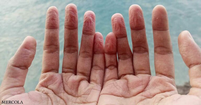 Why Do Fingers and Toes Get Pruny in Water?
