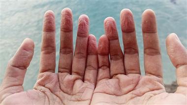fingers toes get pruny water