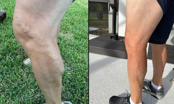 dmso legs