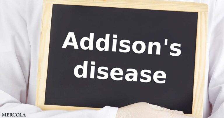 Comprehensive Treatment Options for Addison's Disease