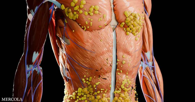 Hidden Fat Threatens Your Brain's Future Health