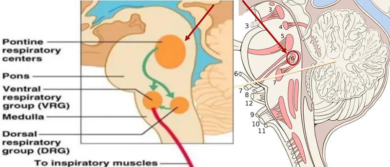 microstrokes cranial nerves