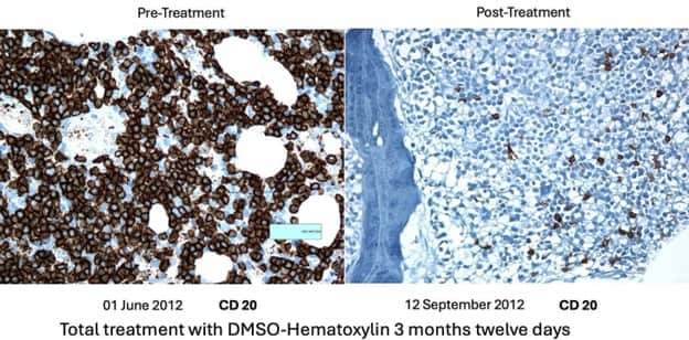 treatment with dmso-hematoxylin