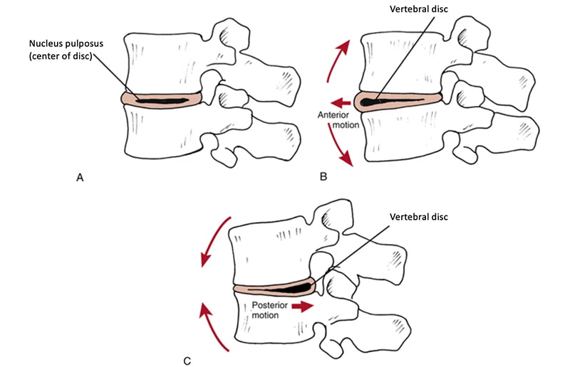 effects of spinal movements on the intervertebral disc