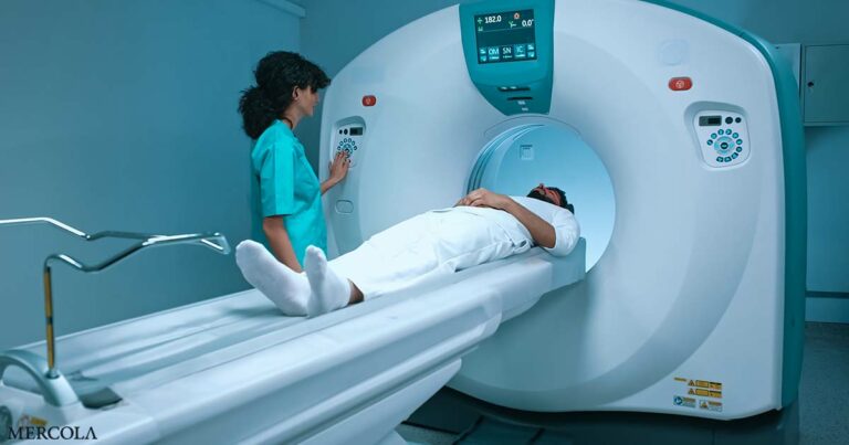 Are CT Scans the Hidden Cancer Risk No One Warned You About?