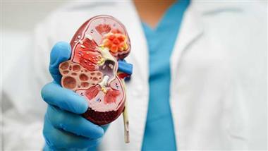 low testosterone kidney stones risk