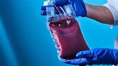 uvbi revolutionized medicine
