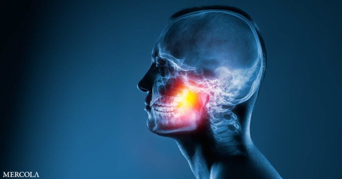 Bone Medications and Steroids Linked to Increased Risk of Jaw Disease