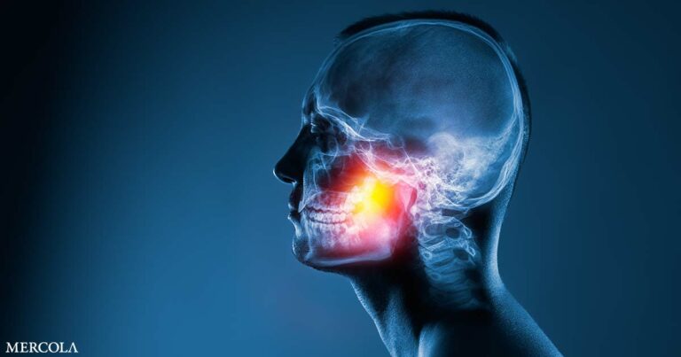 Bone Medications and Steroids Linked to Increased Risk of Jaw Disease
