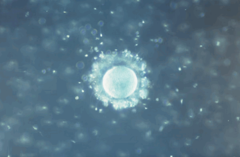 Scientists find microplastics in semen and ovaries